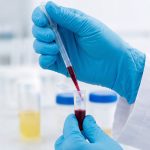 Laboratory tests